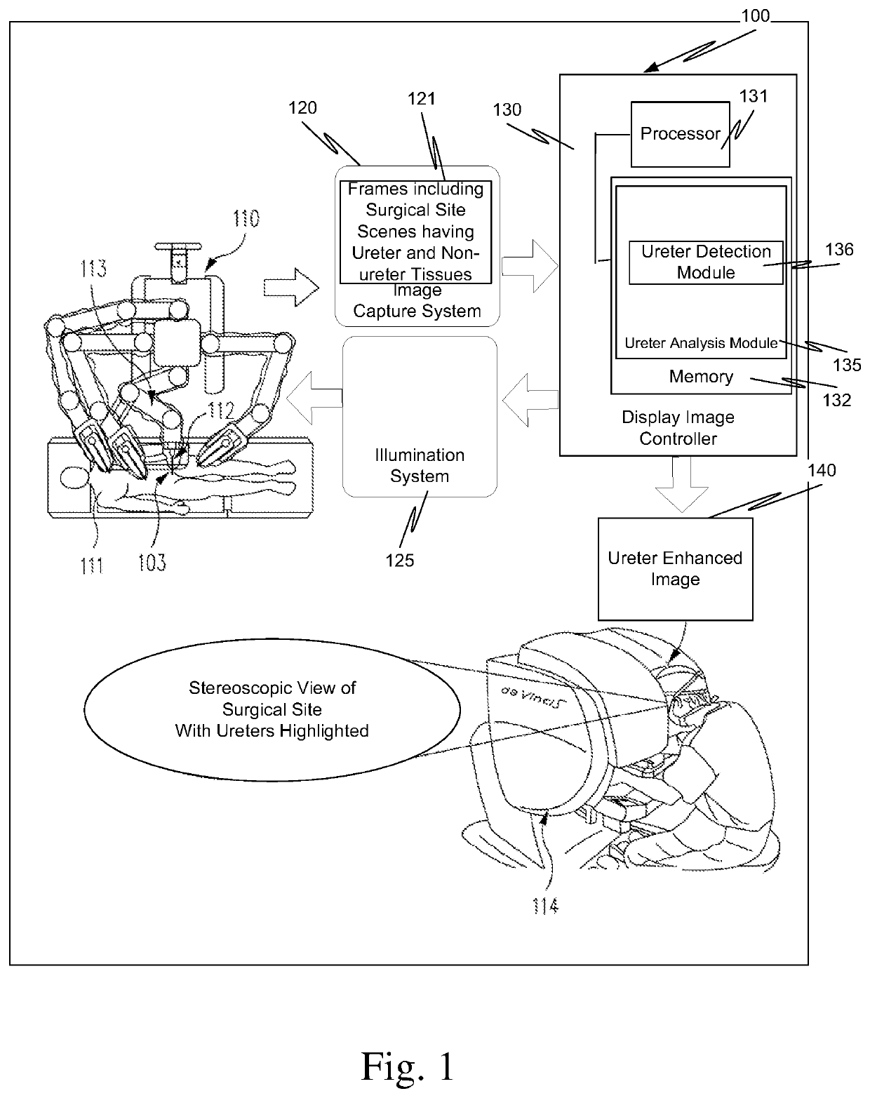 Ureter detection using waveband-selective imaging