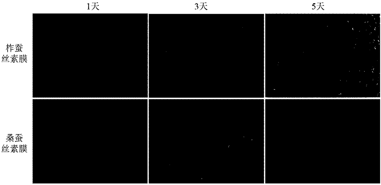 Double-silk fibroin nerve graft