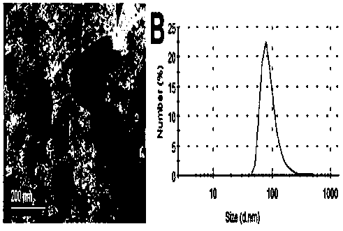 Application of mesenchymal stem cell exosome preparation in treating alopecia areata