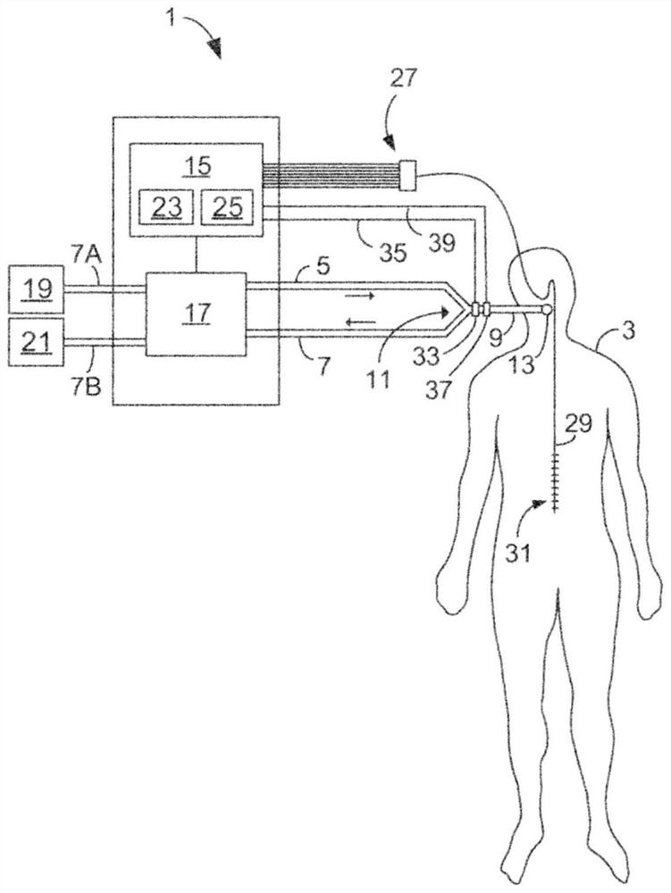 Bioelectric Control Ventilation Mode