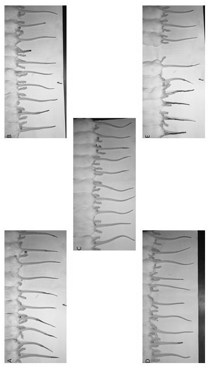 Traditional Chinese medicine for preventing and treating cerebral arterial thrombosis