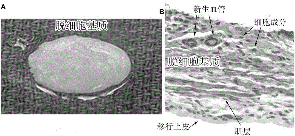 Preparation method and application of acellular matrix biological material