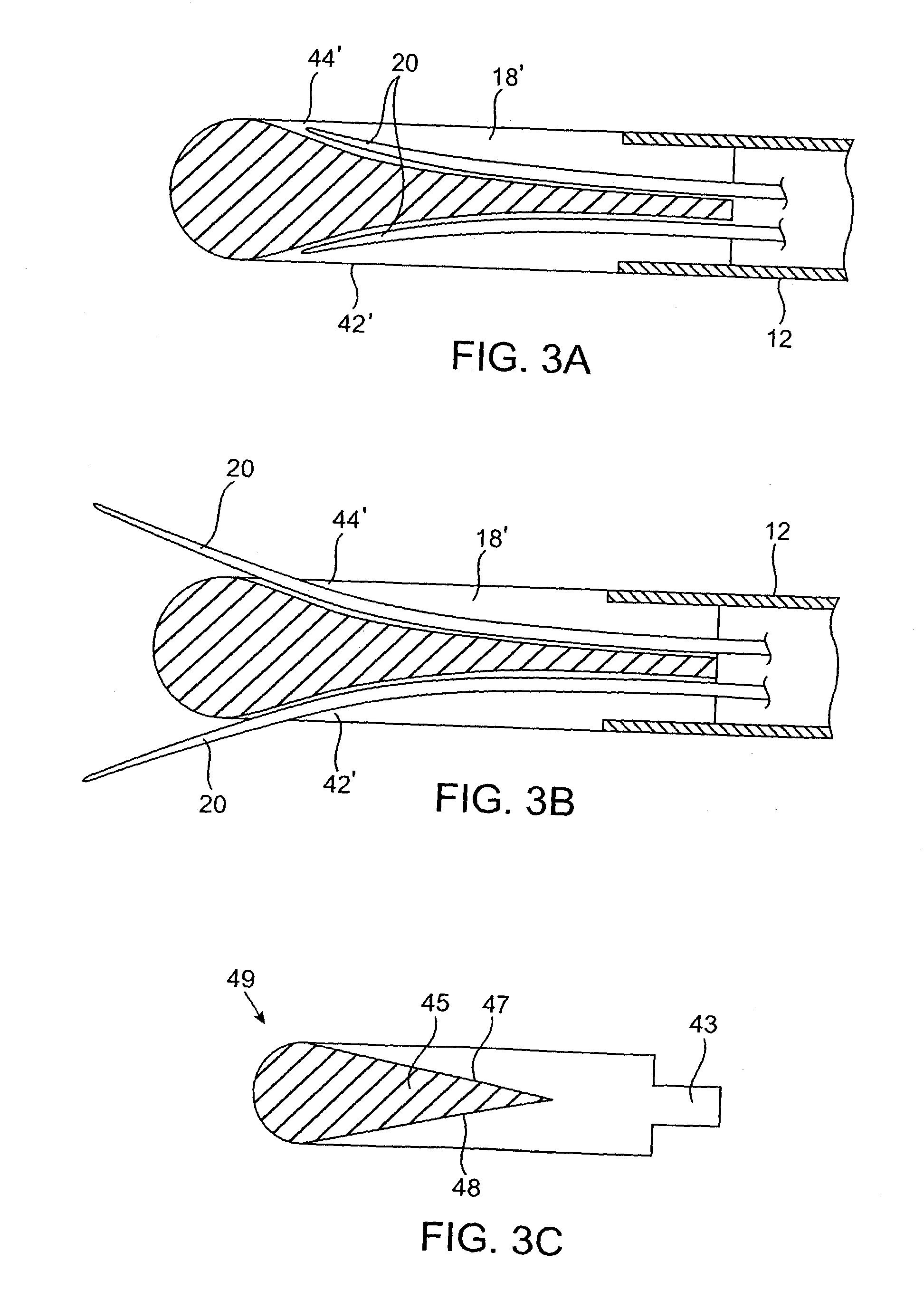 Method and apparatus for avulsion of varicose veins