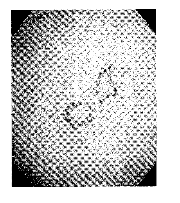 Method of diagnosing a lower urinary tract disorder