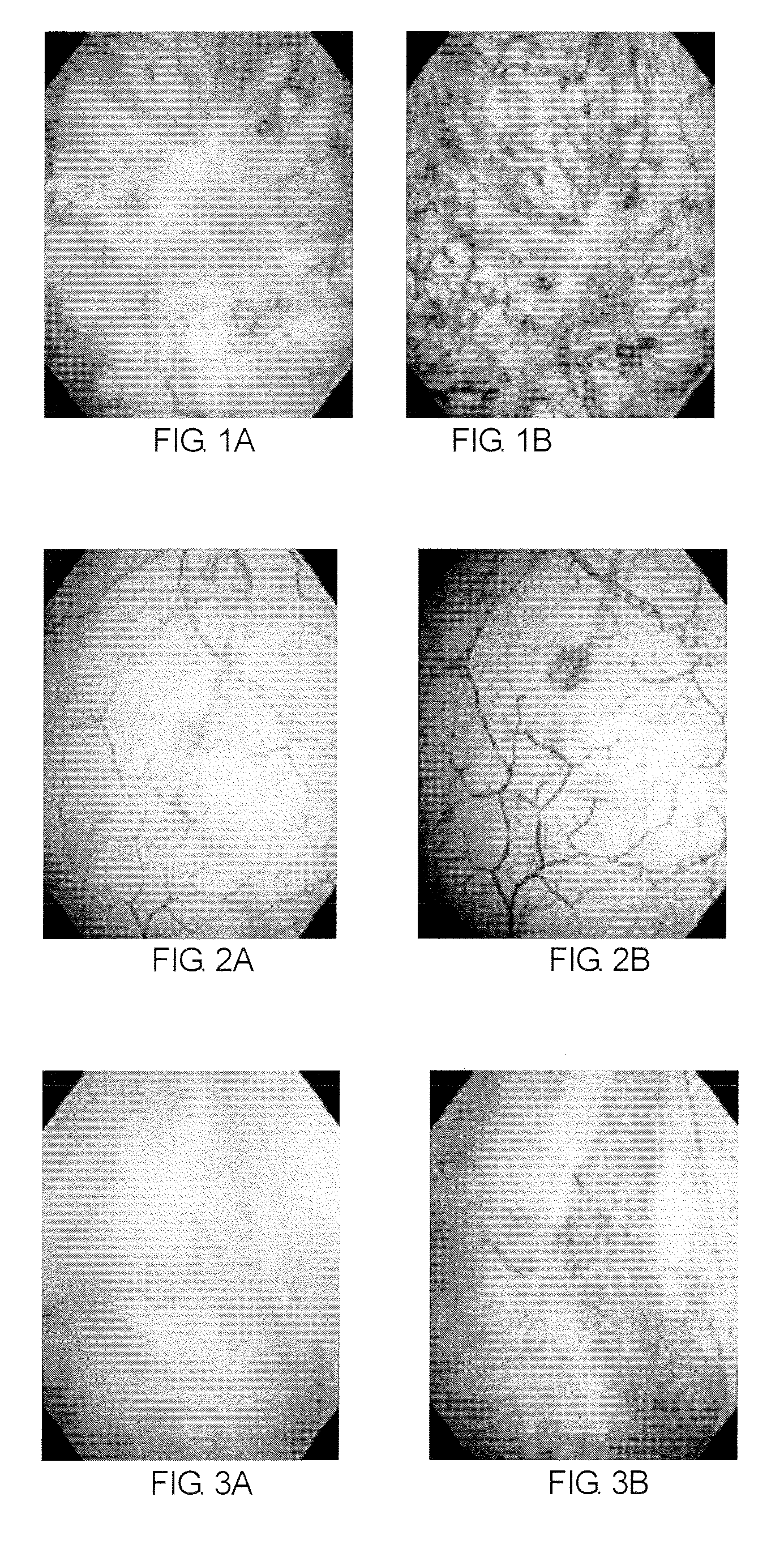 Method of diagnosing a lower urinary tract disorder