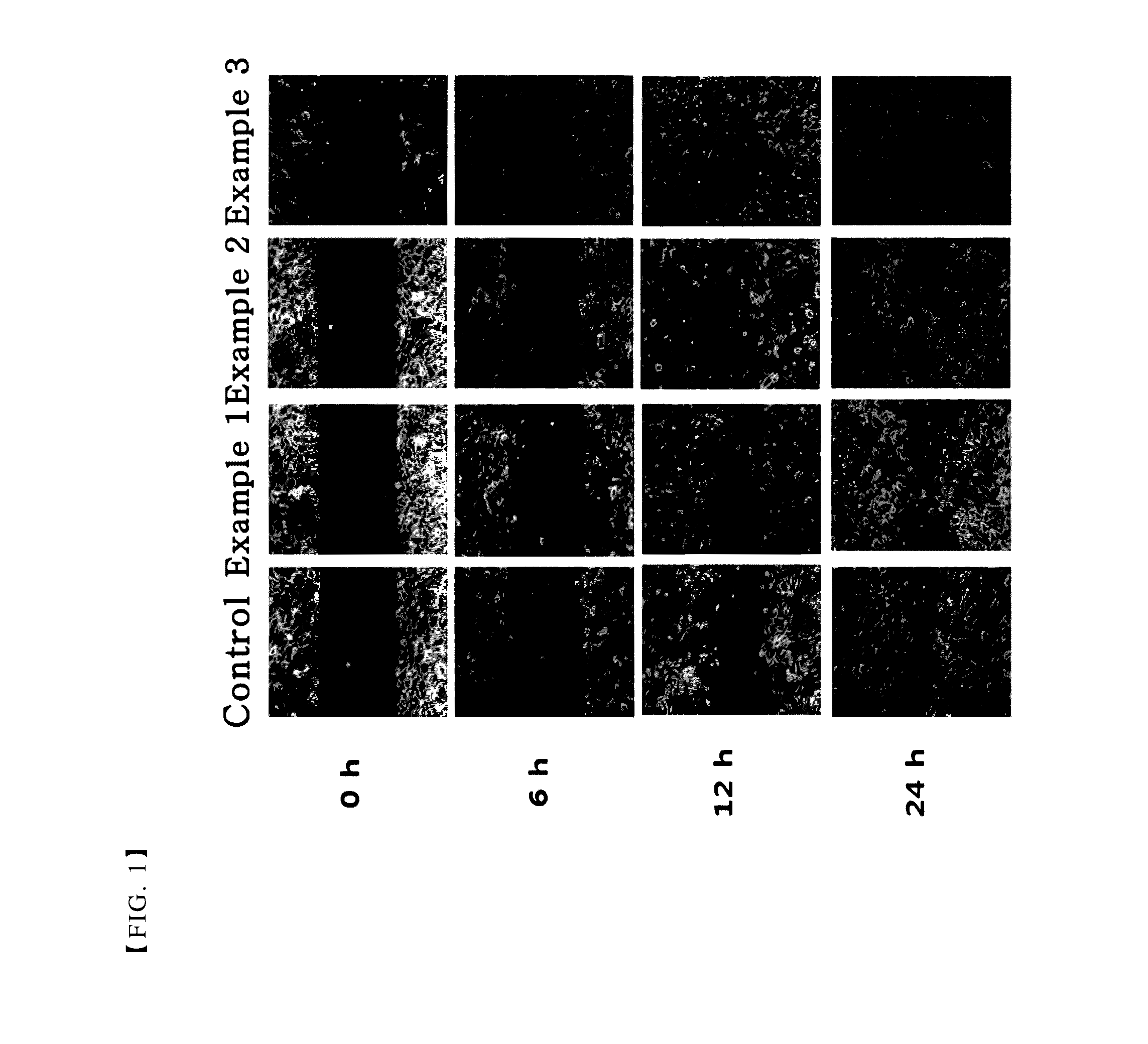 Pharmaceutical composition for treating or preventing corneal wound comprising thymosin beta 4 and citric acid