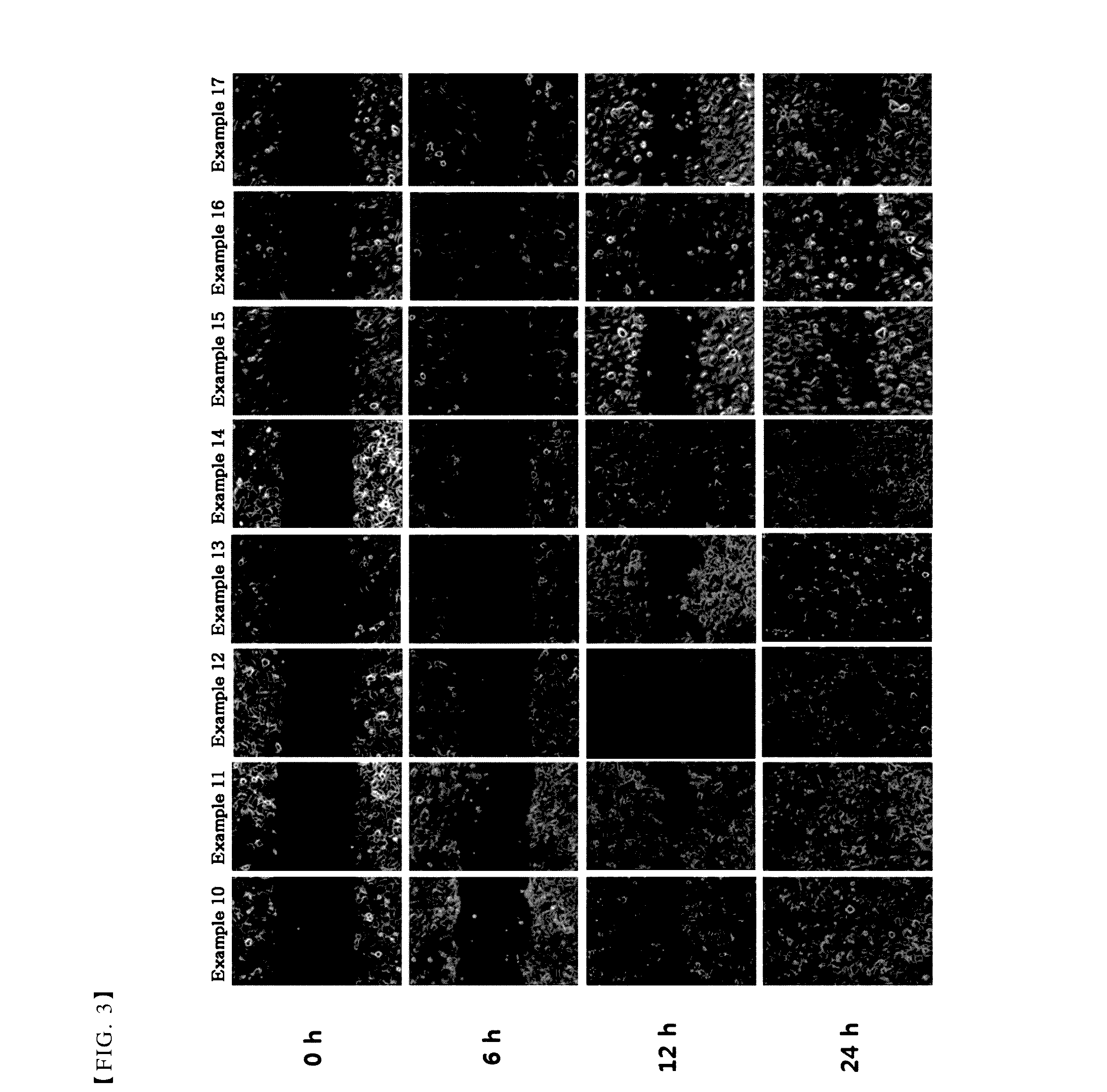 Pharmaceutical composition for treating or preventing corneal wound comprising thymosin beta 4 and citric acid