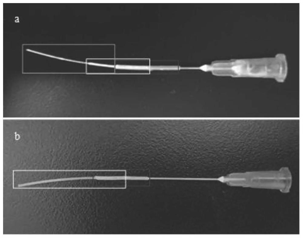 Construction method and application of megacolon animal model