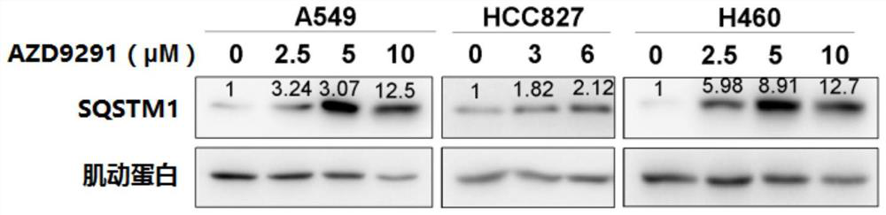 EGFR (epidermal growth factor receptor) kinase inhibitor and application thereof in preparation of anti-cancer drugs