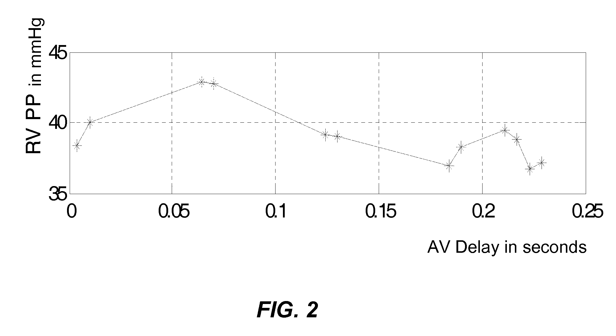 Monitoring Right Ventricular Hemodynamic Function During Pacing Optimization