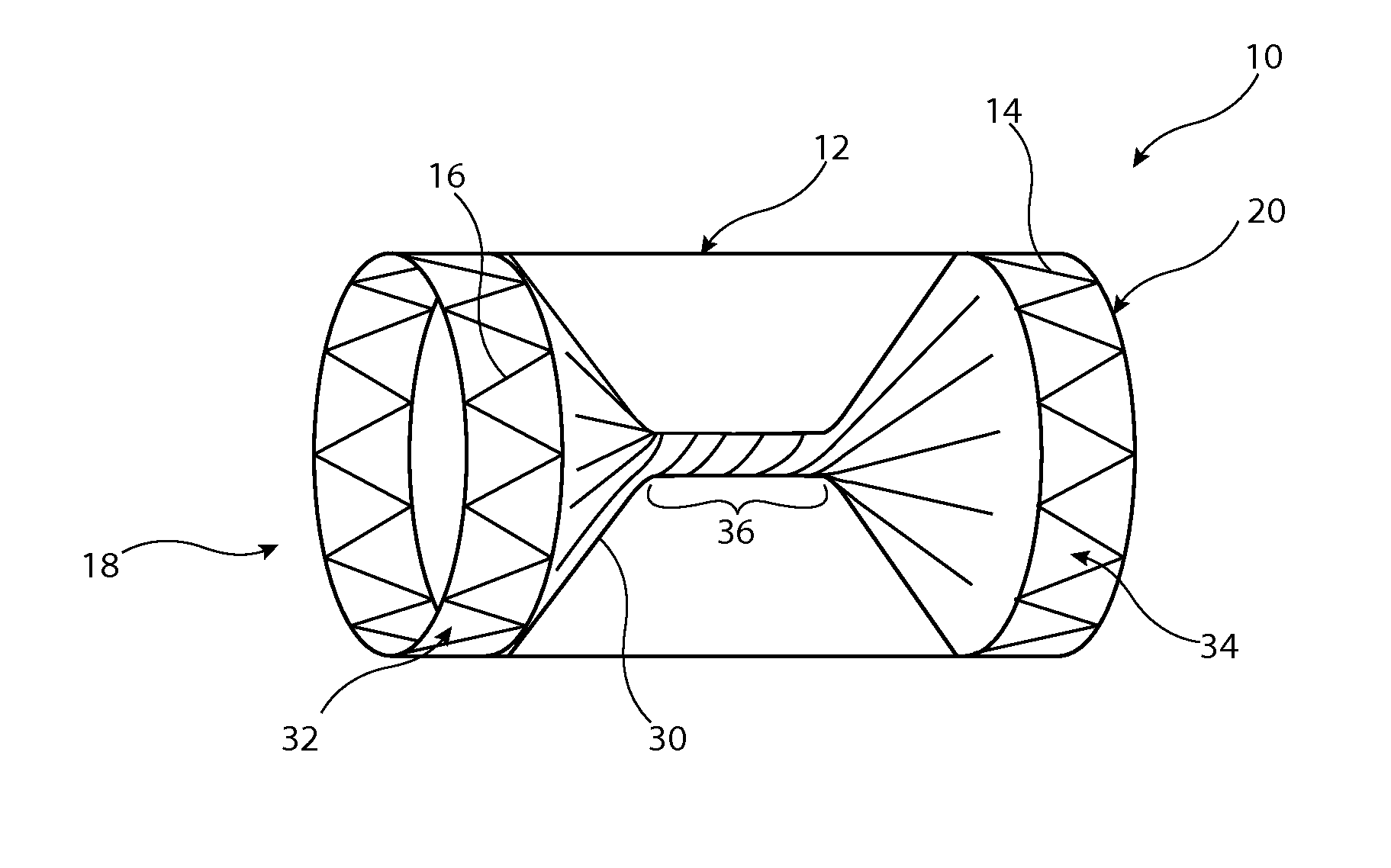 Implantable medical device with twisted element