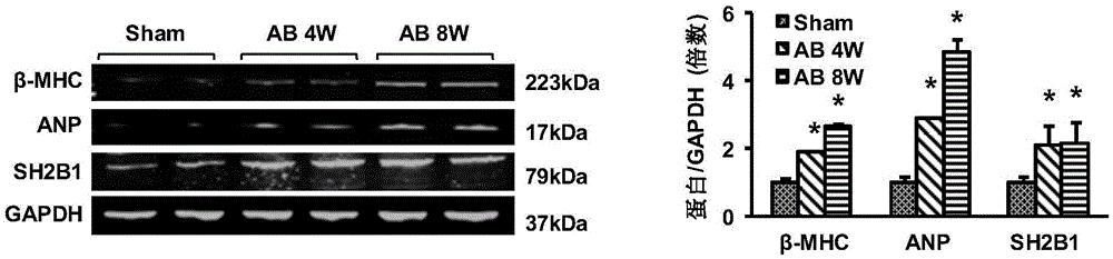 The function and application of sh2b adapter protein 1 (sh2b1) in the treatment of cardiac hypertrophy