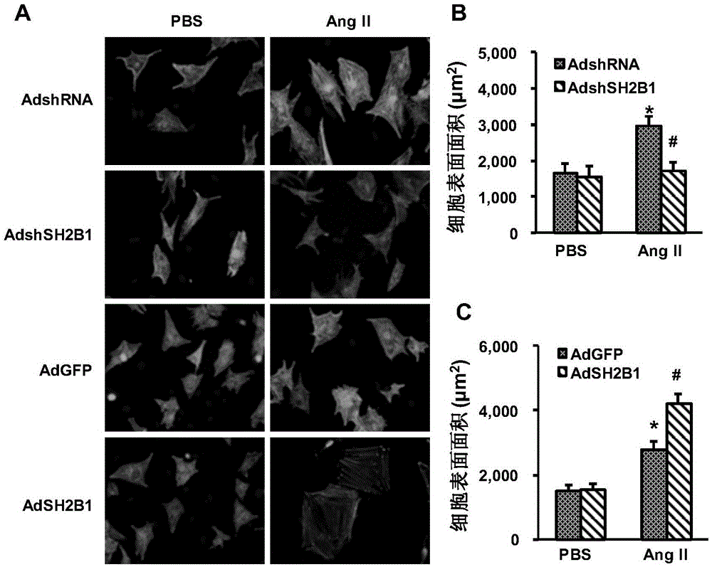 The function and application of sh2b adapter protein 1 (sh2b1) in the treatment of cardiac hypertrophy