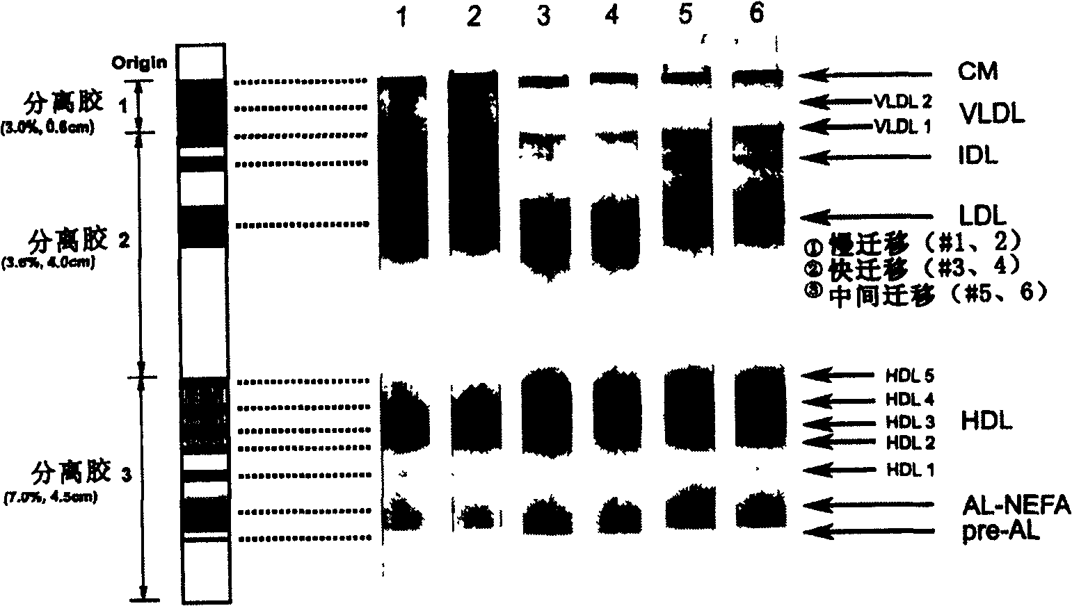 Method for gel electrophoresis separation of serum lipoprotein and quantization detection thereof