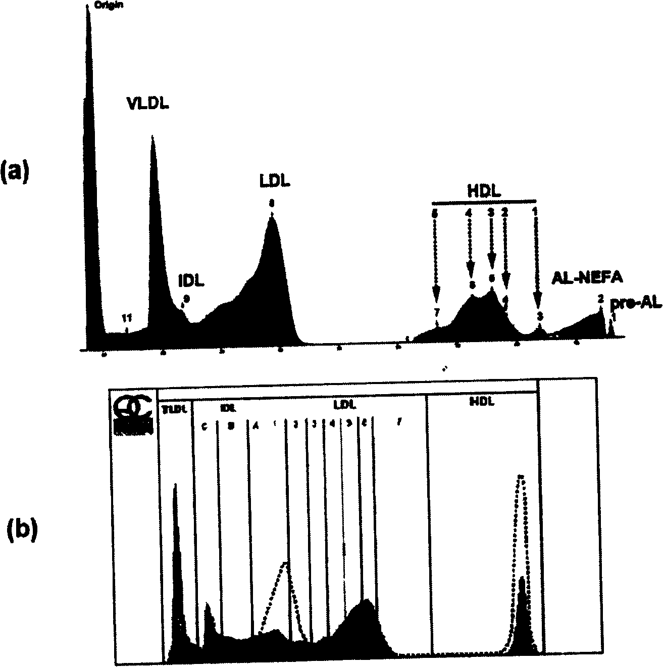 Method for gel electrophoresis separation of serum lipoprotein and quantization detection thereof