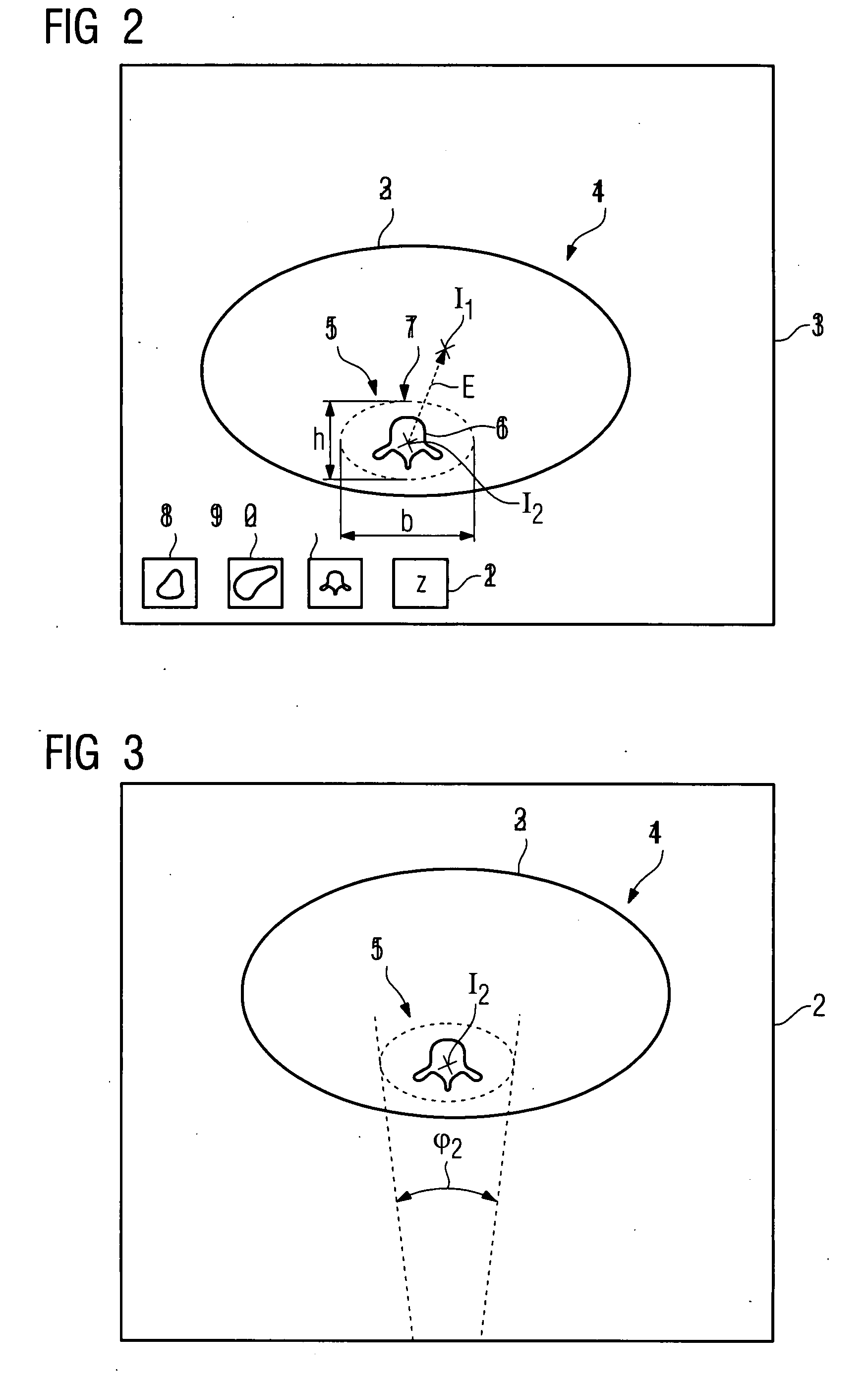 Method for recording images of a definable region of an examination object using a computed tomography facility