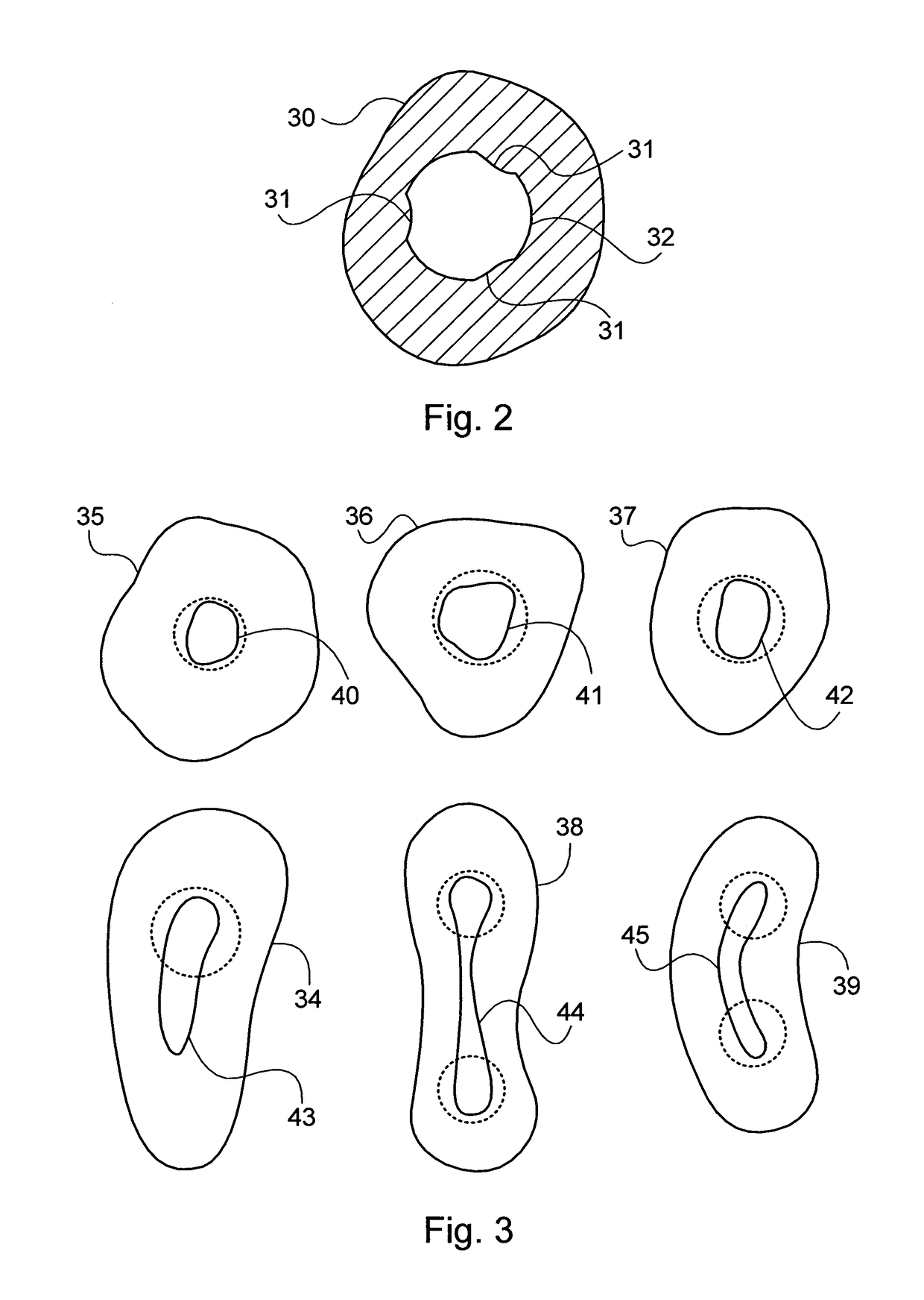 System for endodontic treatment