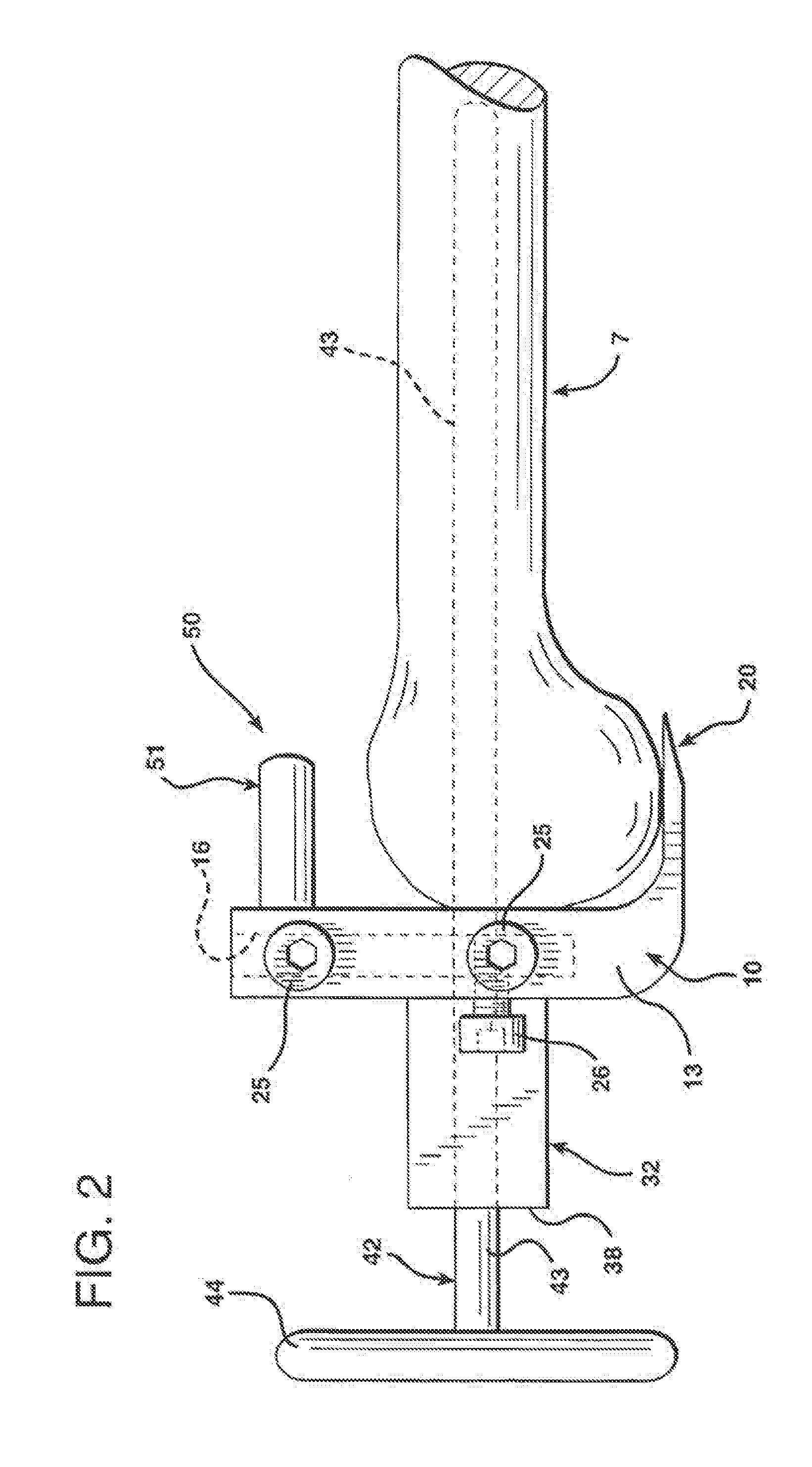 Apparatuses for femoral and tibial resection