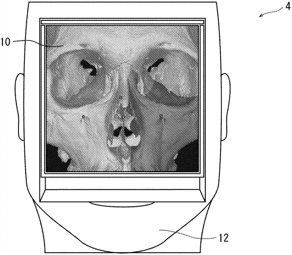 Training device for endoscopic endonasal skull base surgery