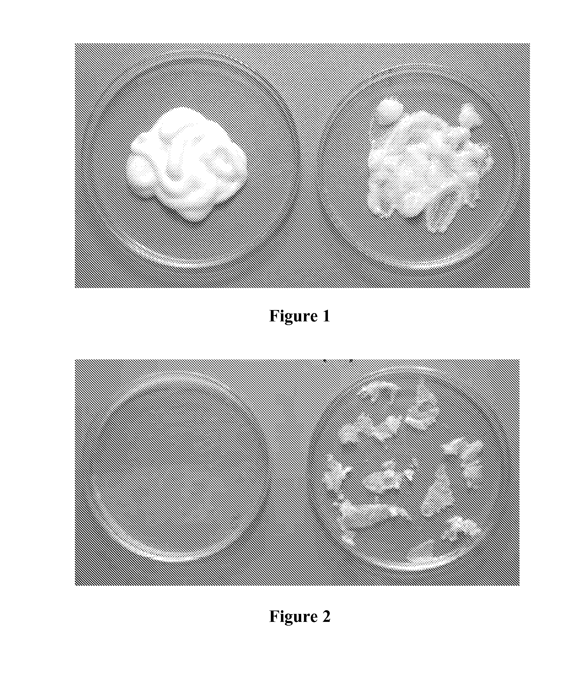 Medicinal Cream Made Using Hydrocortisone Acetate and A Process To Make The Same