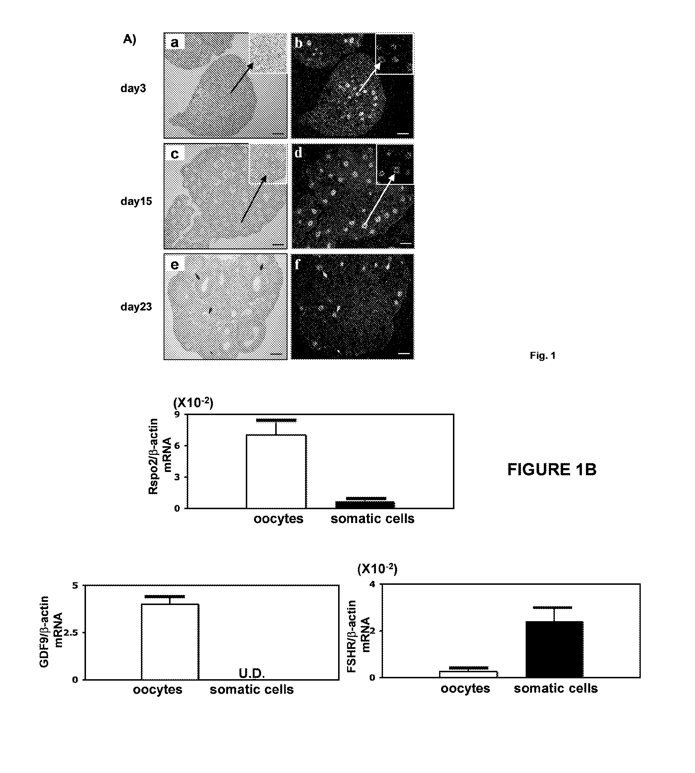 Stimulation of Ovarian Follicle Development and Oocyte Maturation