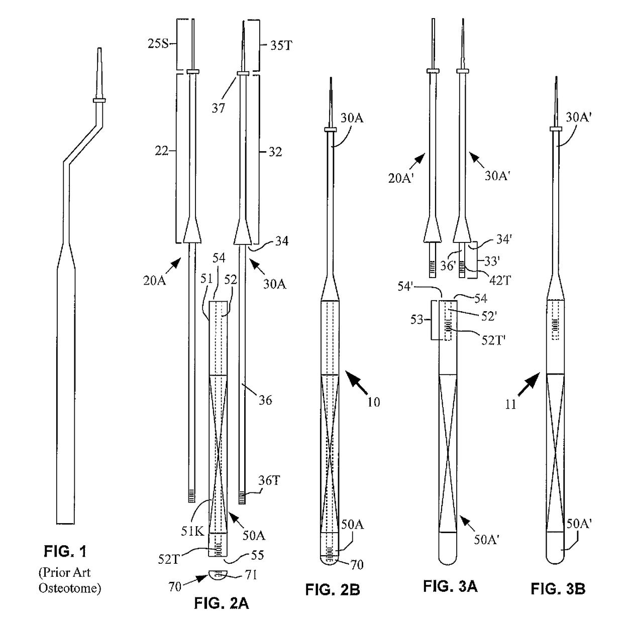 Apparatus and method for sinus lift procedure