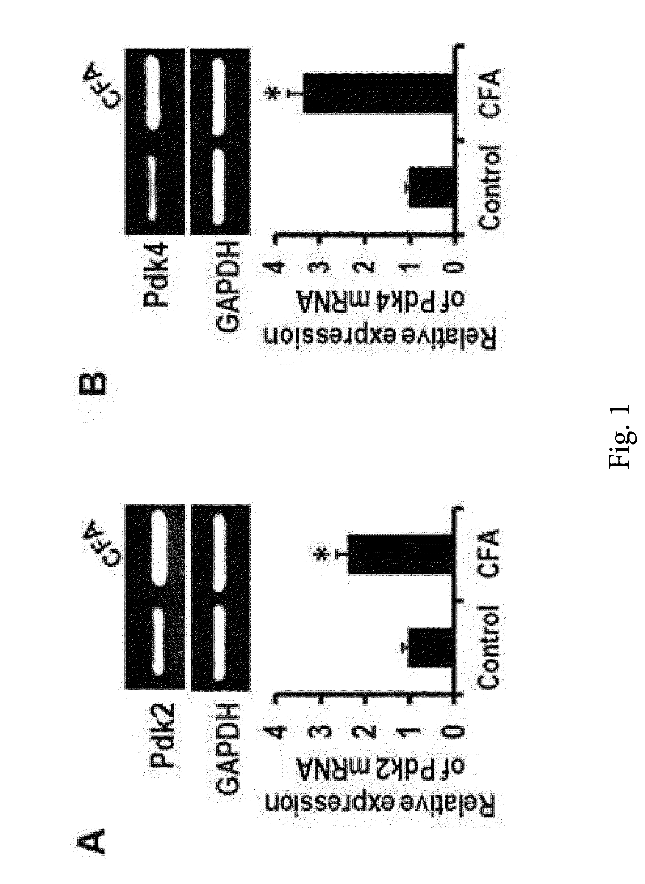 Composition containing pyruvate dehydrogenase kinase inhibitor for treating chronic inflammatory pain