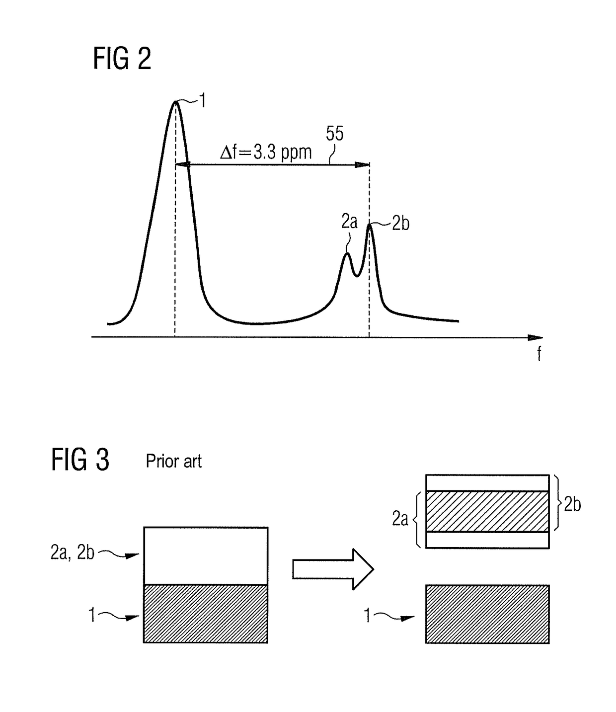 MR imaging with signal suppression of a spin series