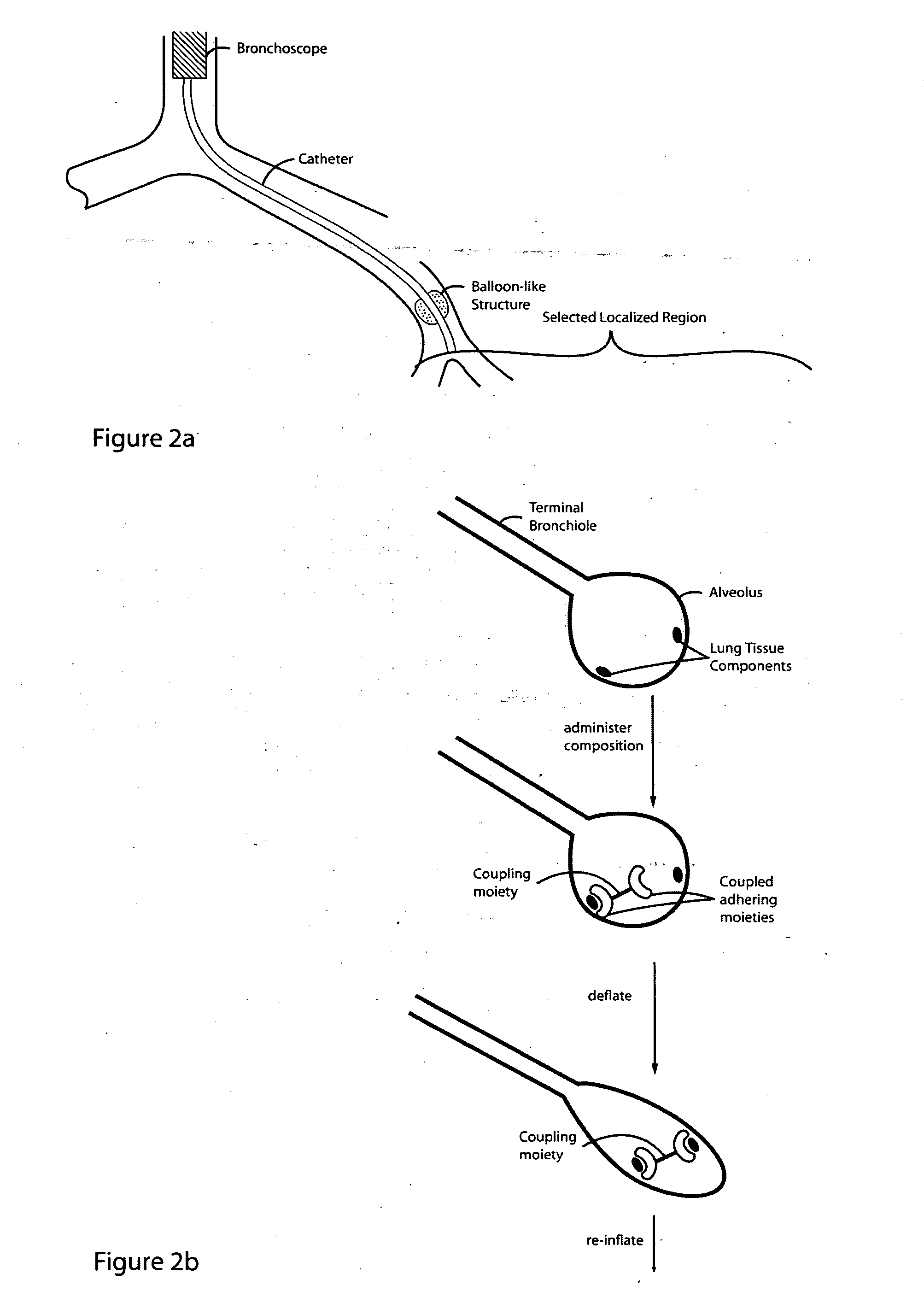 Lung volume reduction using glue composition