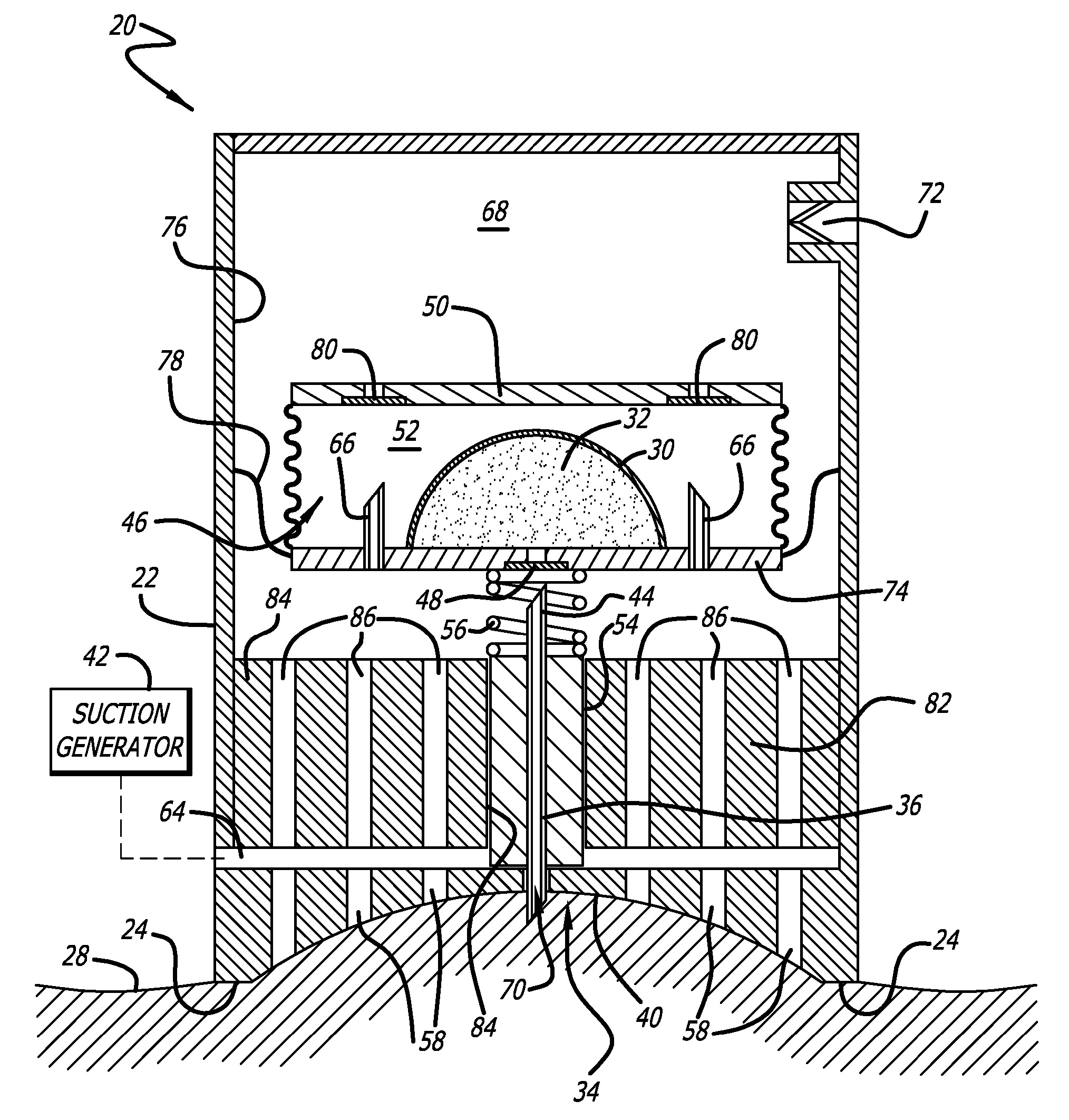 Cutaneous stabilization by vacuum for delivery of micro-needle array