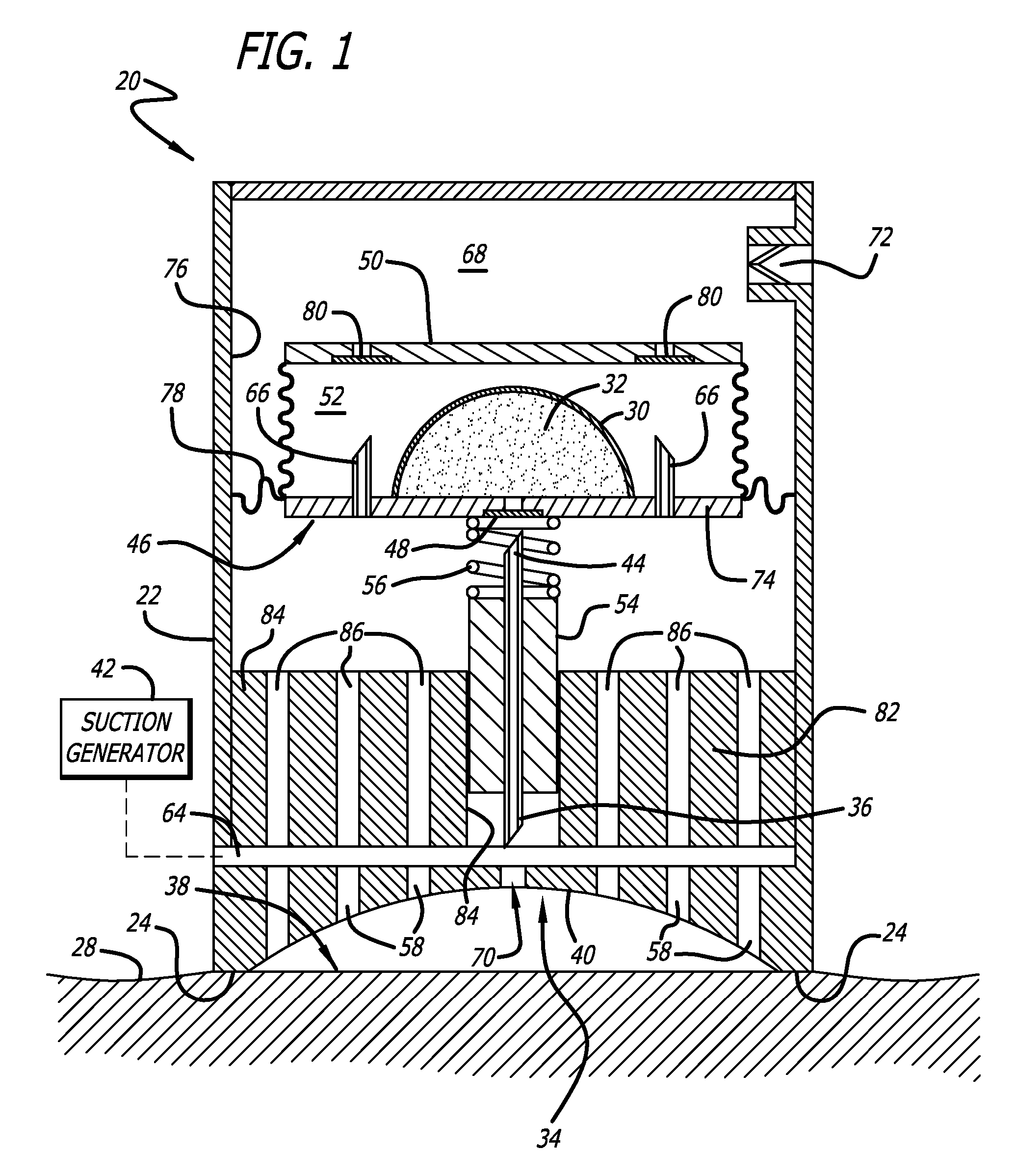 Cutaneous stabilization by vacuum for delivery of micro-needle array