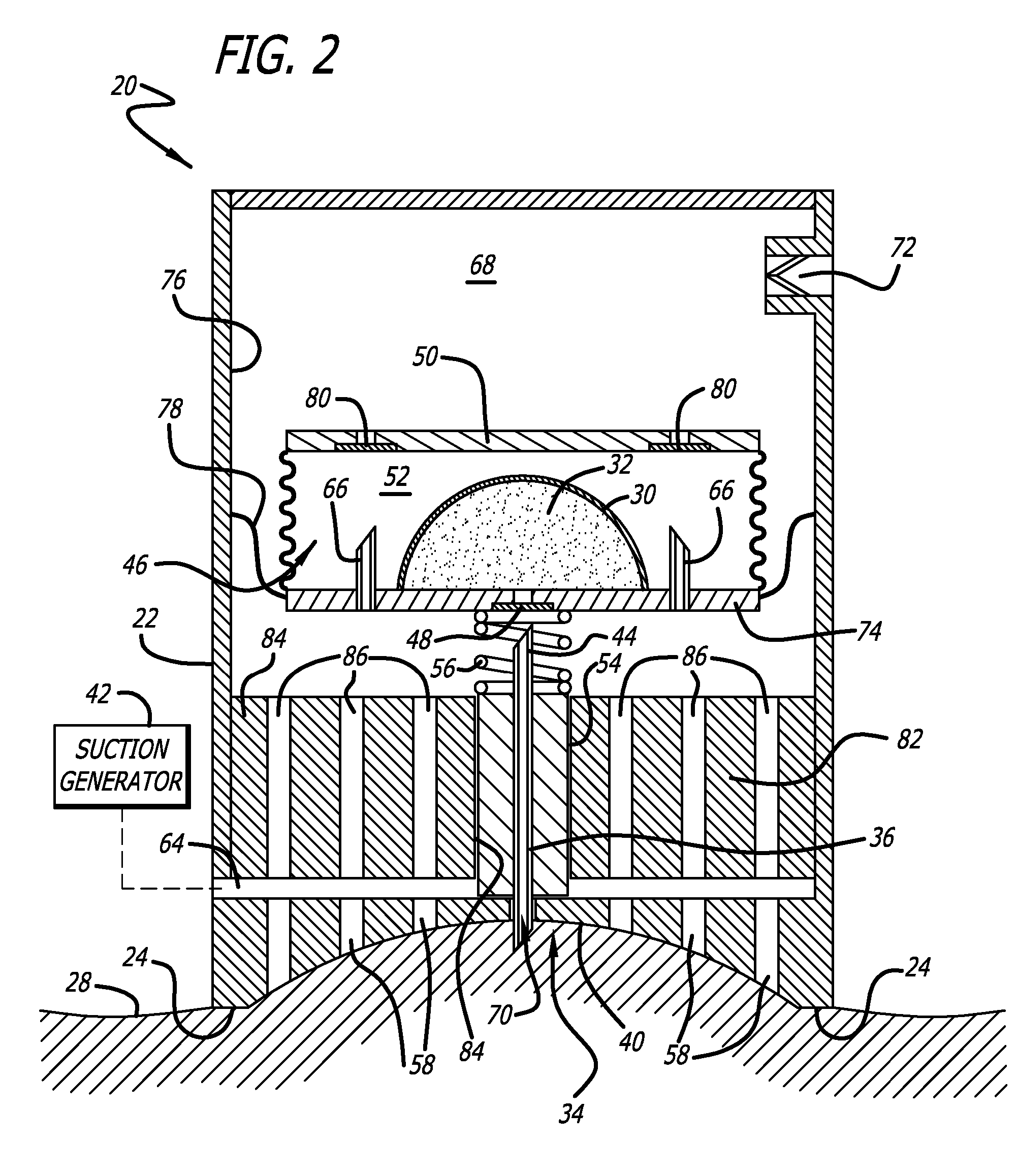 Cutaneous stabilization by vacuum for delivery of micro-needle array