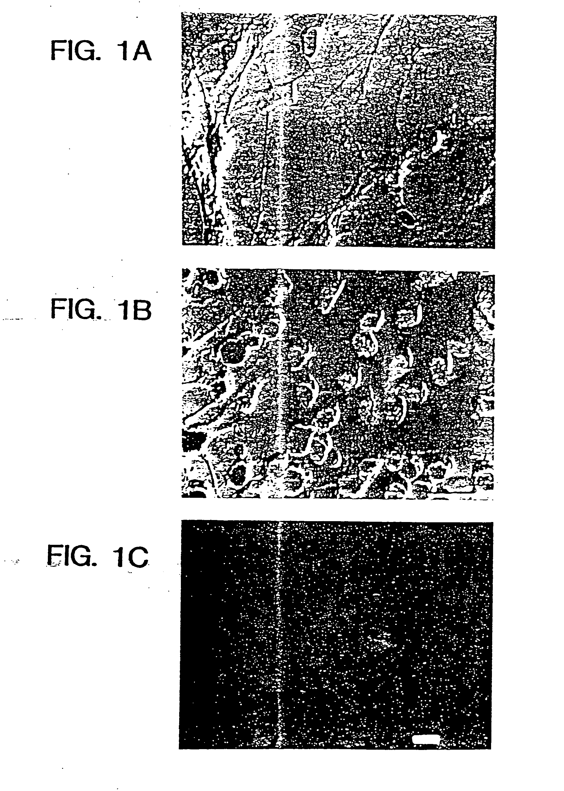 Method for production of neuroblasts