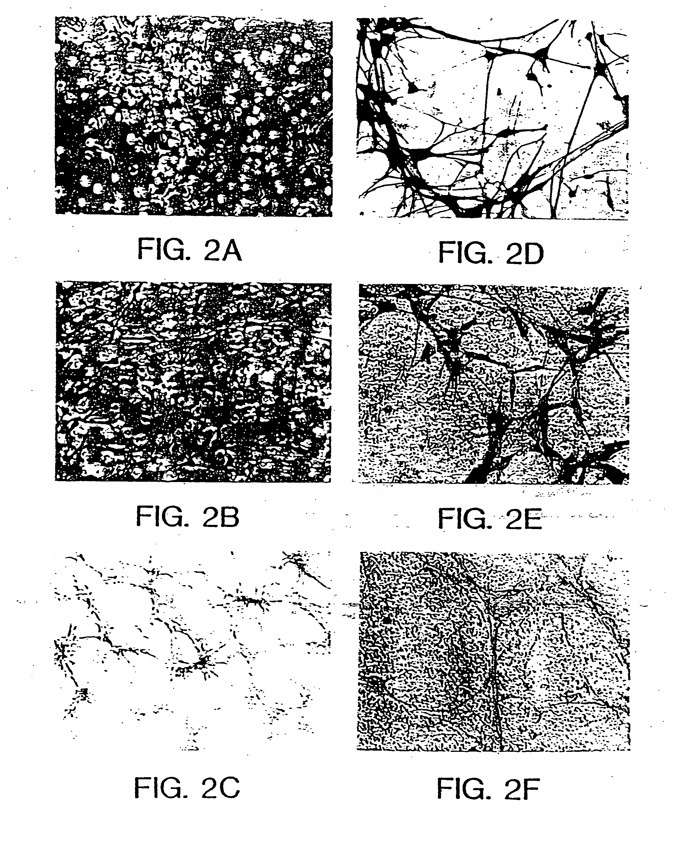 Method for production of neuroblasts