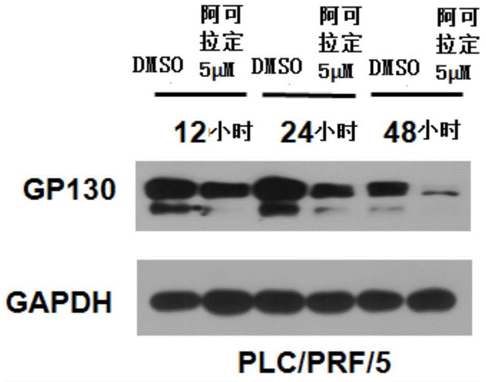 Application of Icaritin in preparation of drugs for curing GP130 related diseases