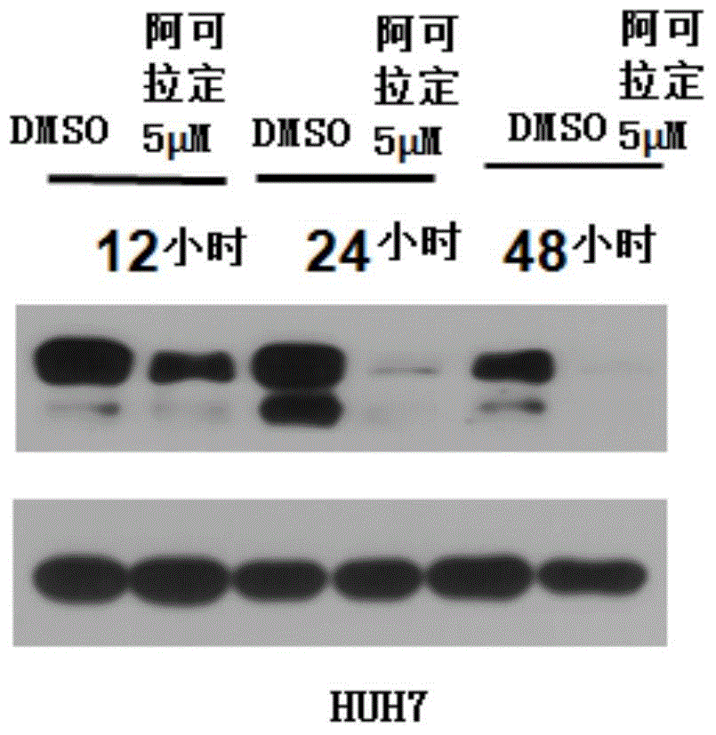 Application of Icaritin in preparation of drugs for curing GP130 related diseases