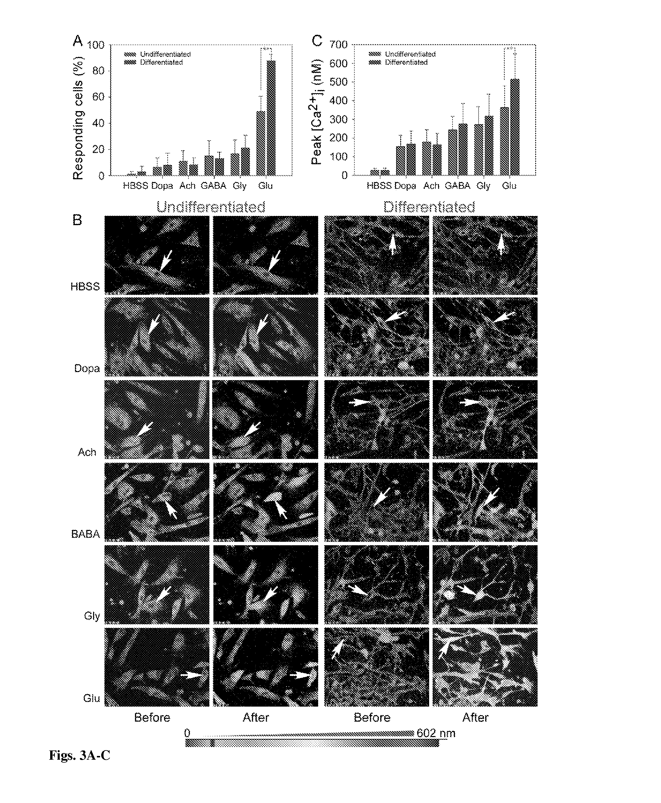 Human Persistent Fetal Vasculature Neural Progenitors for Transplantation in the Inner Retina