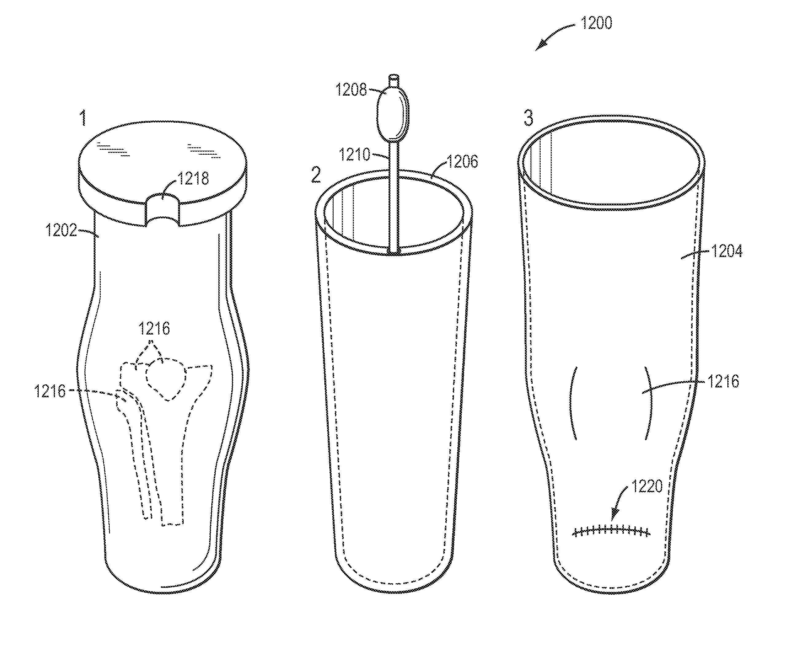 Residual limb model