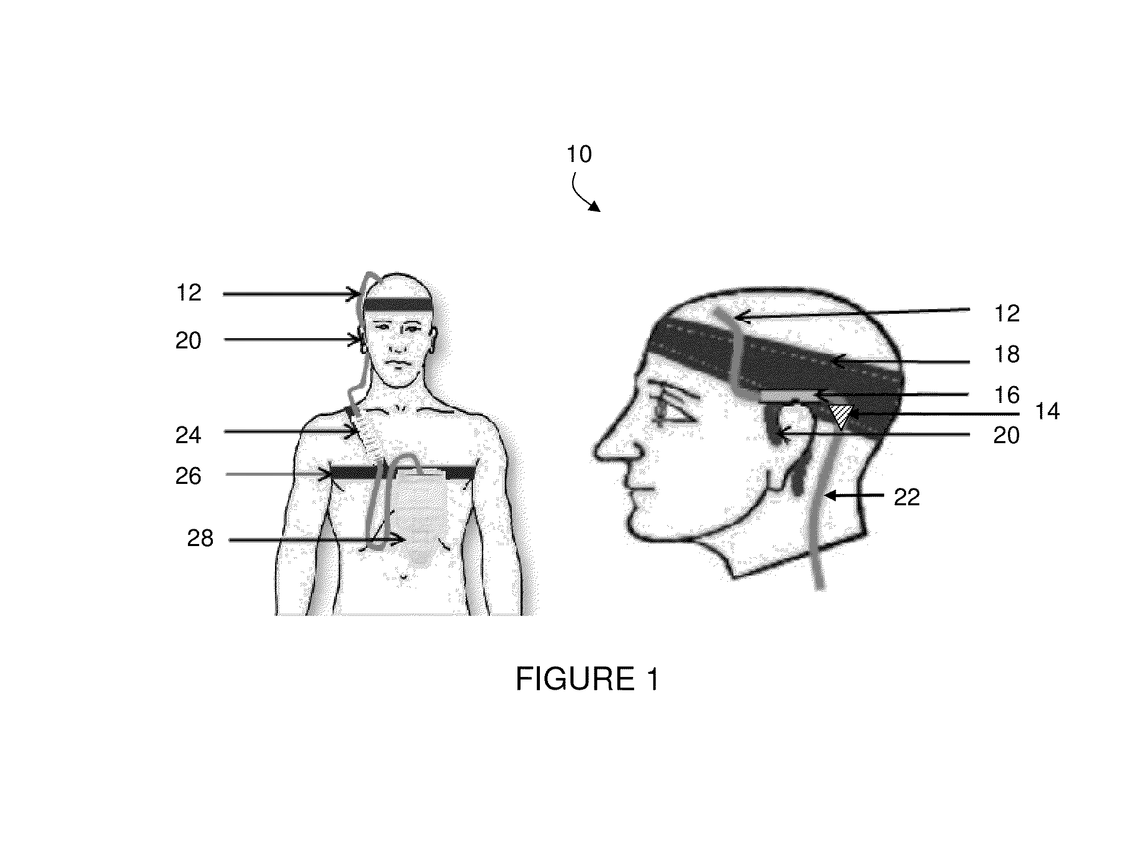 Wearable external ventricular drain system