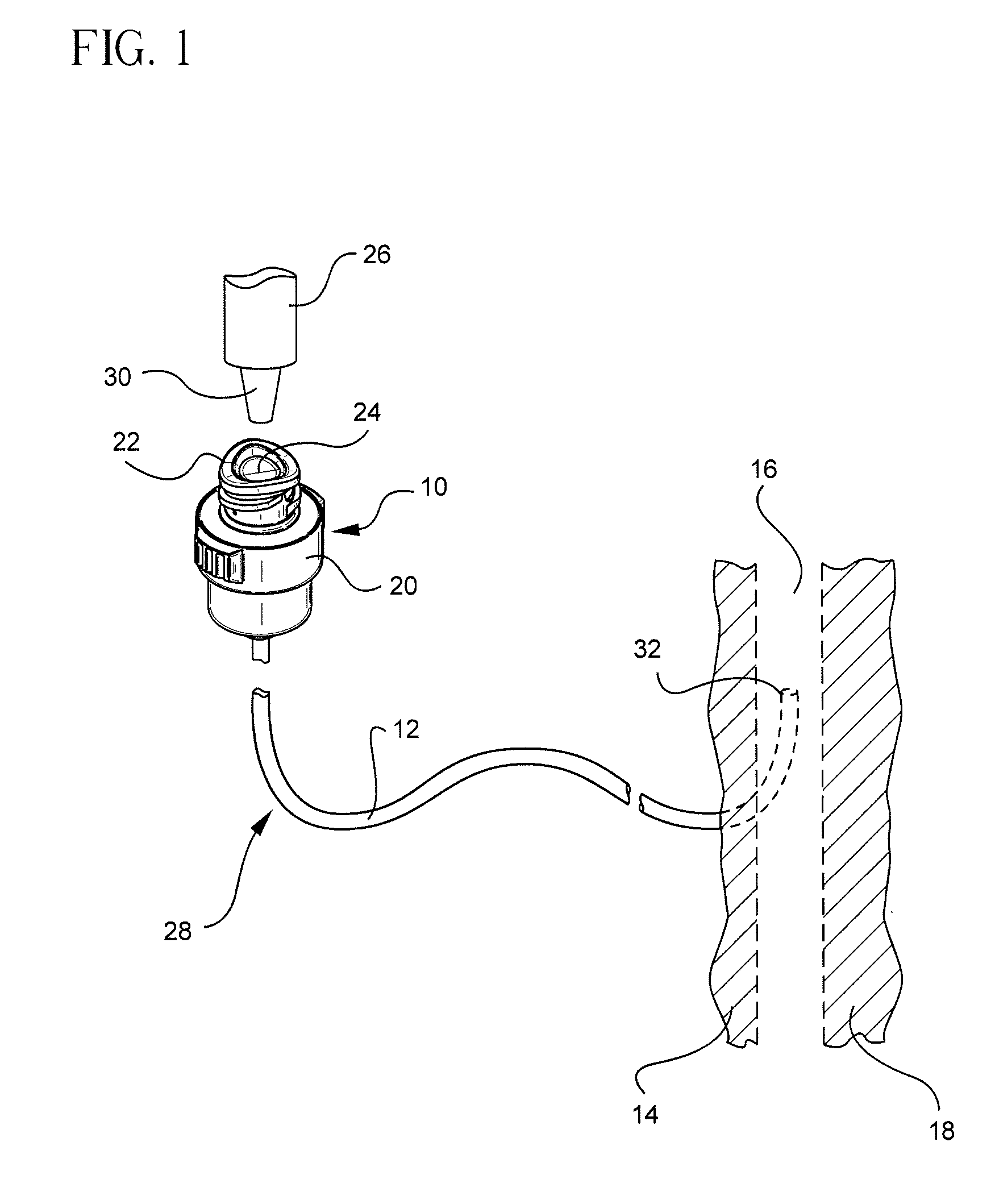 Vascular access device gas displacement