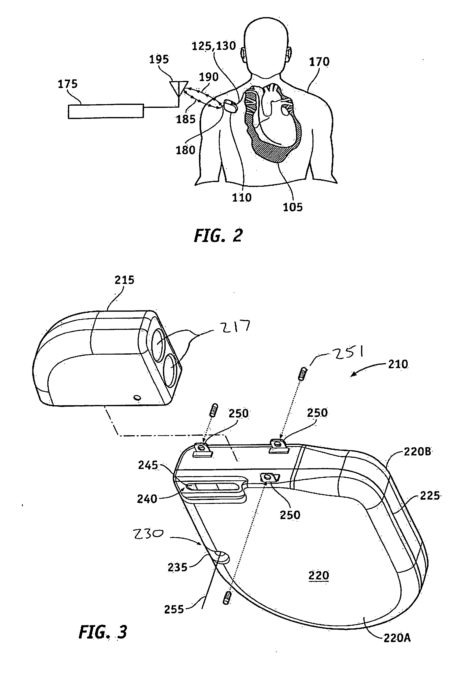 Radio frequency antenna flexible circuit interconnect with unique micro connectors