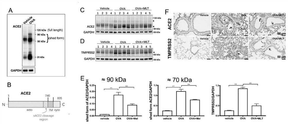 Application of melatonin in preparation of medicine for inhibiting expression of novel coronavirus SARS-CoV-2 receptor