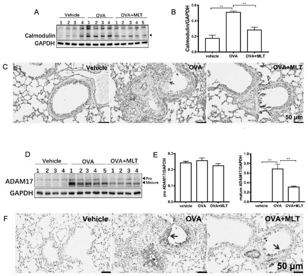 Application of melatonin in preparation of medicine for inhibiting expression of novel coronavirus SARS-CoV-2 receptor