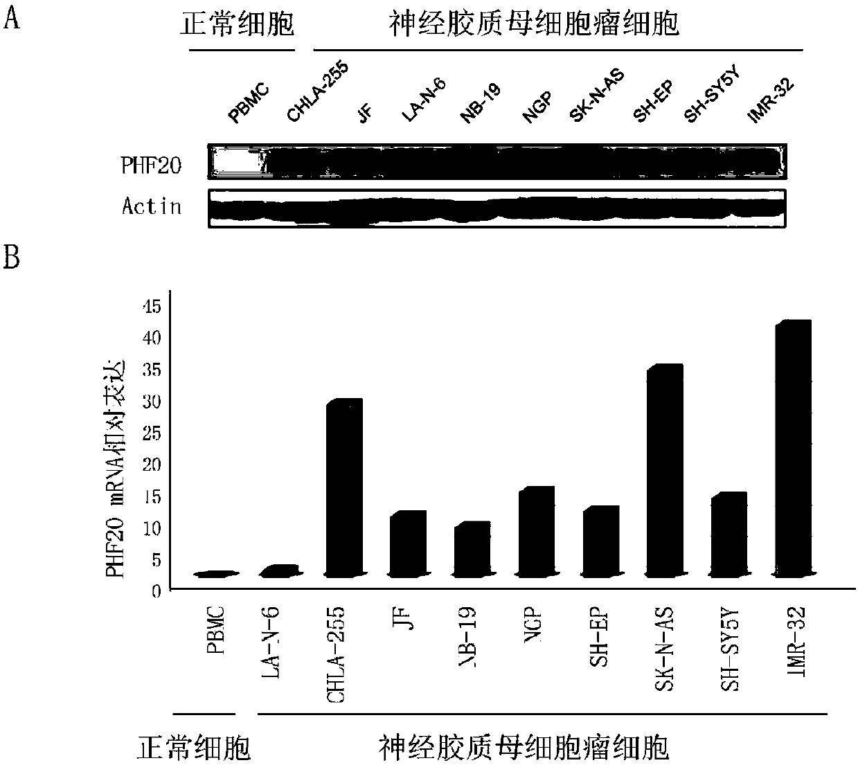 Neuroblastoma-related tumor marker and application thereof