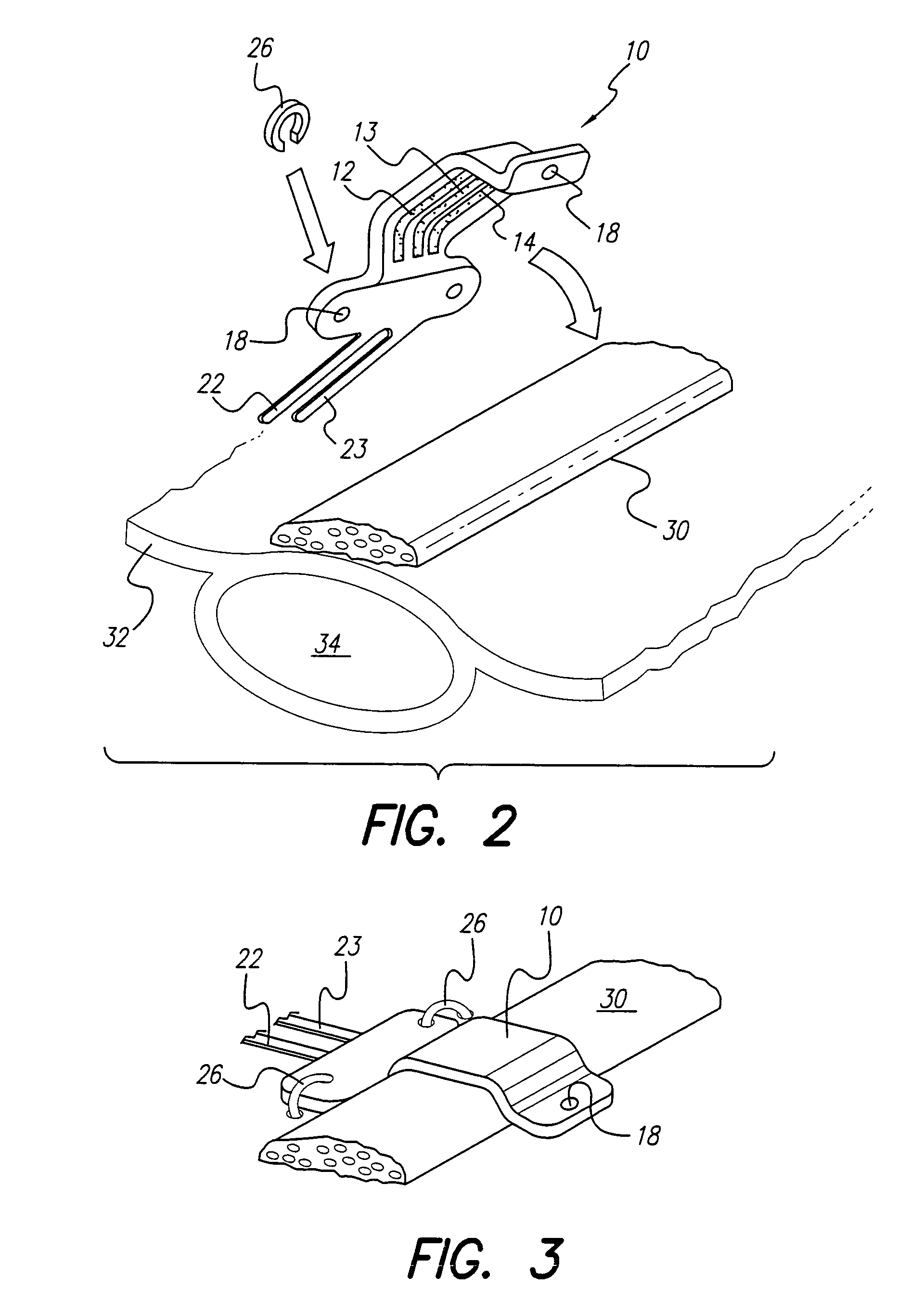 Curved paddle electrode for use with a neurostimulator