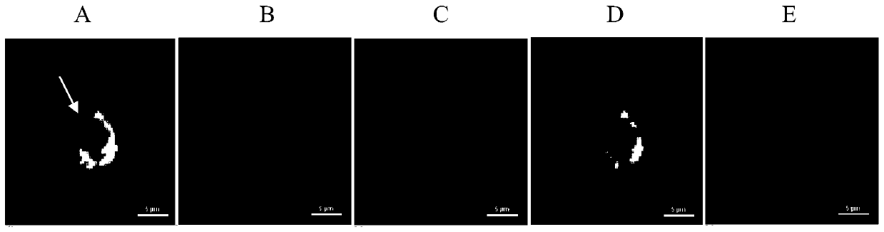 Enrichment detection method for epithelial-mesenchymal hybrid and PD-L1 positive circulating tumor cell