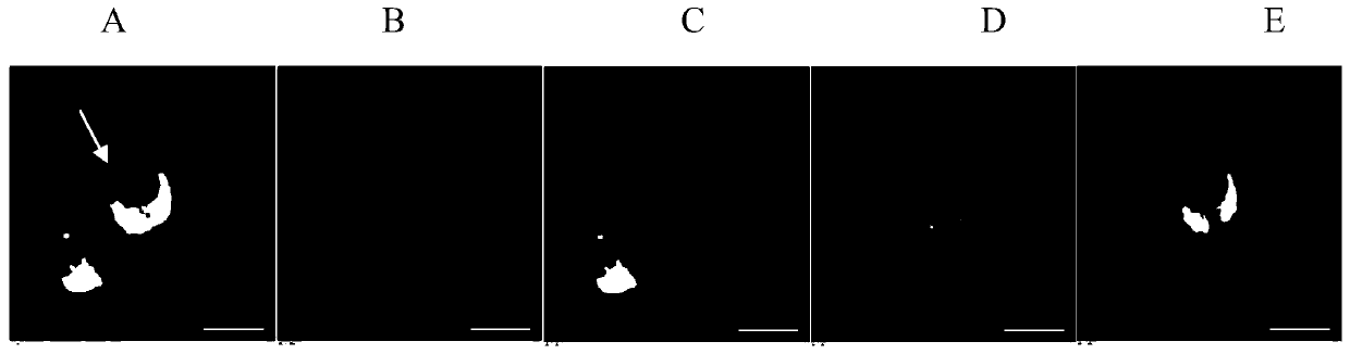 Enrichment detection method for epithelial-mesenchymal hybrid and PD-L1 positive circulating tumor cell