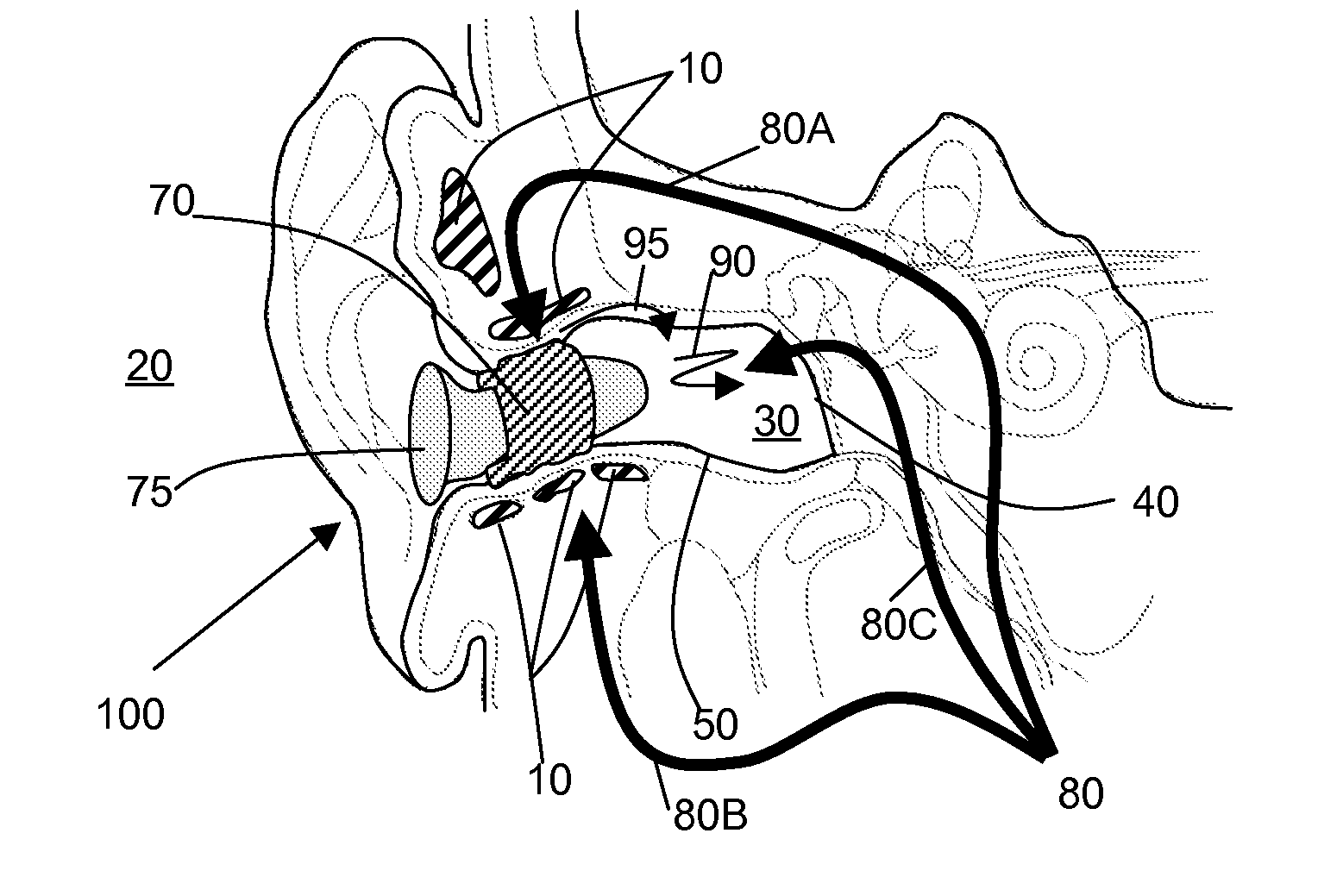 Expandable earpiece sealing devices and methods