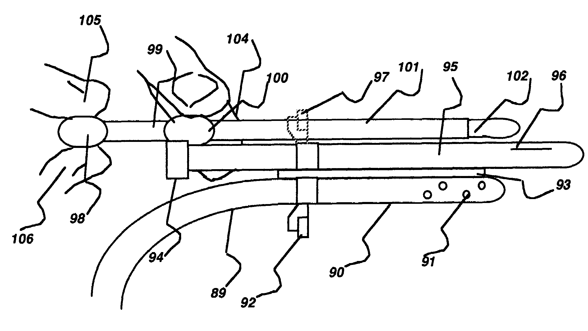 Apparatus and method for hypothermia and rewarming by altering the temperature of the cerebrospinal fluid in the brain