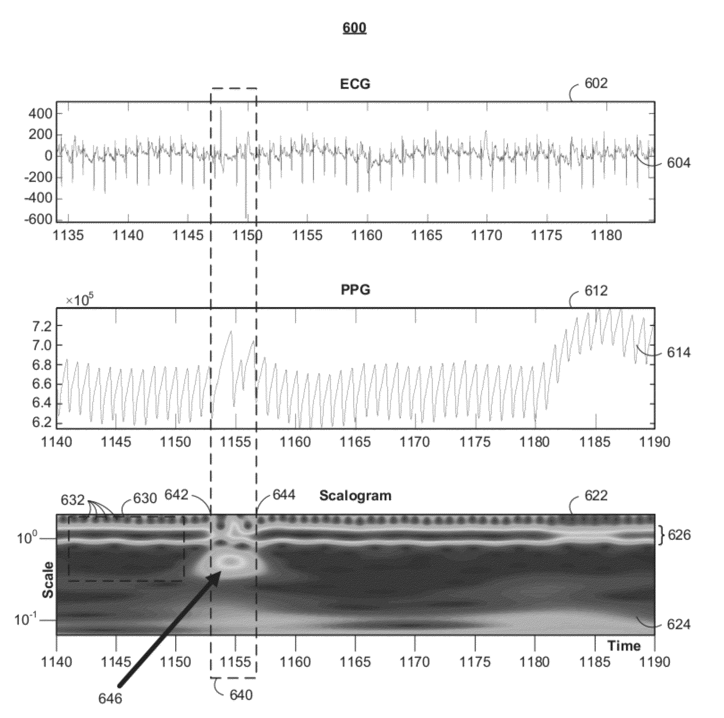 Systems and methods for detecting and monitoring arrhythmias using the PPG